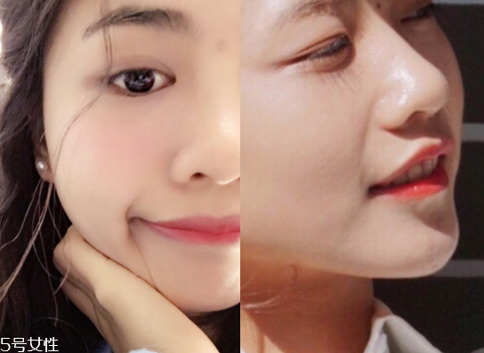 tripollar stop童顏機(jī)好用嗎 tripollar stop美容儀怎么用 tripollar stop童顏機(jī)好用嗎 tripollar stop美容儀怎么用