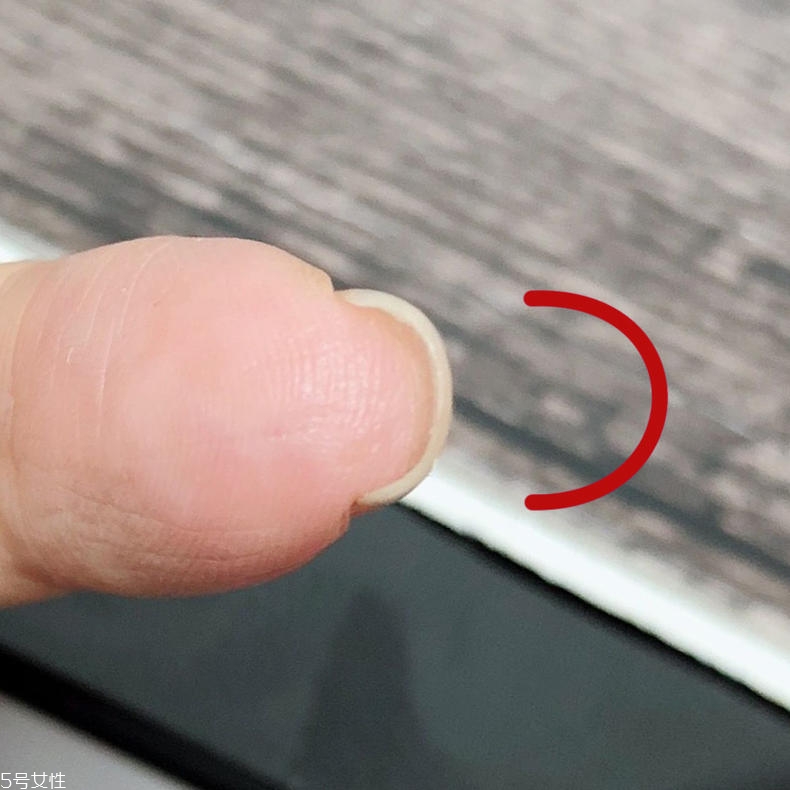 扇形甲怎么修復(fù) 扇形甲修復(fù)方法 扇形甲怎么修復(fù) 扇形甲修復(fù)方法