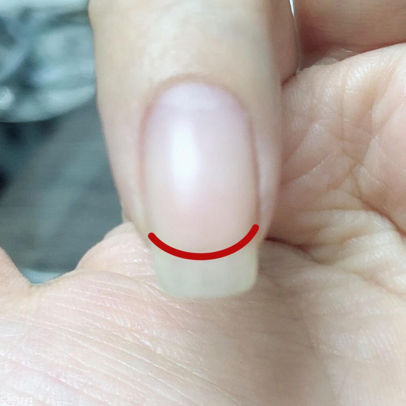 扇形甲怎么修復(fù) 扇形甲修復(fù)方法 扇形甲怎么修復(fù) 扇形甲修復(fù)方法