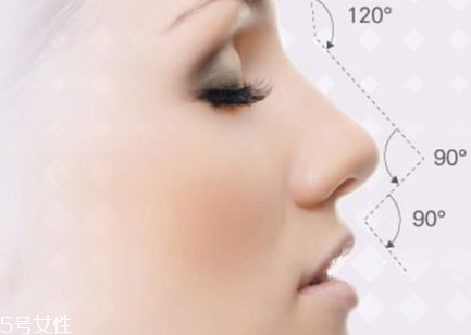 隆鼻后可以運(yùn)動(dòng)嗎 隆鼻手術(shù)后運(yùn)動(dòng)的壞處 隆鼻后可以運(yùn)動(dòng)嗎 隆鼻手術(shù)后運(yùn)動(dòng)的壞處