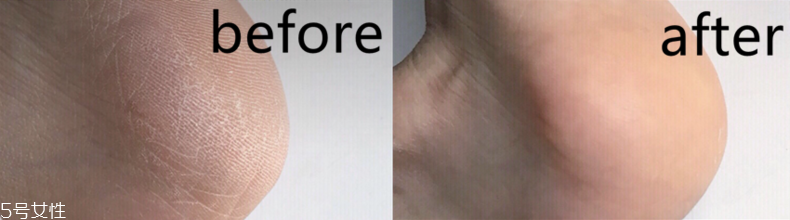 飛利浦電動(dòng)美足儀怎么樣 飛利浦電動(dòng)美足儀評(píng)測(cè) 飛利浦電動(dòng)美足儀怎么樣 飛利浦電動(dòng)美足儀評(píng)測(cè)