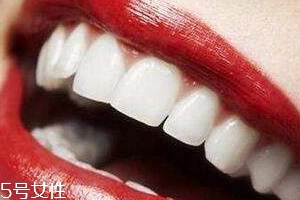 冷光美白會反彈嗎？冷光美白心得