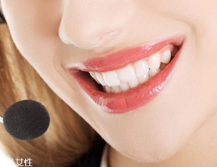 冷光美白會反彈嗎？冷光美白心得