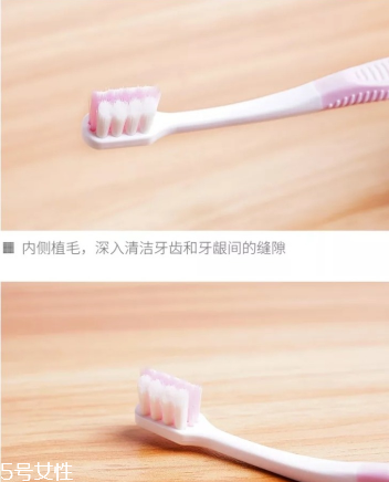 超聲波潔牙牙齒會變白嗎？超聲波潔牙心得