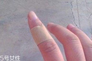 創(chuàng)可貼可以消腫嗎？創(chuàng)可貼有消腫功效嗎？