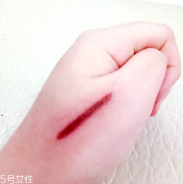 創(chuàng)可貼和肉連著怎么辦？創(chuàng)可貼連著肉怎么處理？