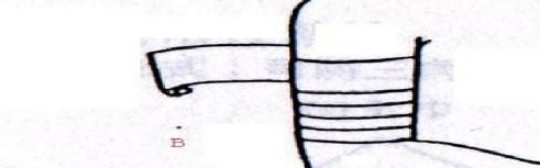 醫(yī)用紗布怎么固定？醫(yī)用紗布怎么包扎？