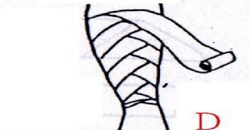 醫(yī)用紗布怎么固定？醫(yī)用紗布怎么包扎？