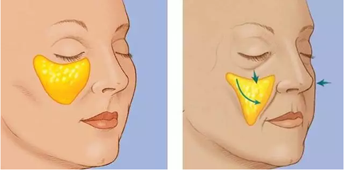 怎么化妝又快又好 超簡(jiǎn)單十分鐘化妝教程 怎么化妝又快又好 超簡(jiǎn)單十分鐘化妝教程