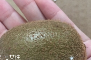 綠心獼猴桃含葉酸嗎？綠心獼猴桃里面有葉酸嗎？