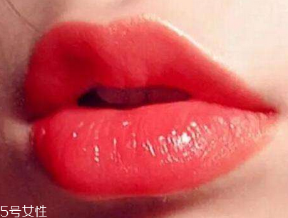 唇珠是什么 玻尿酸豐唇珠效果好嗎 唇珠是什么 玻尿酸豐唇珠效果好嗎