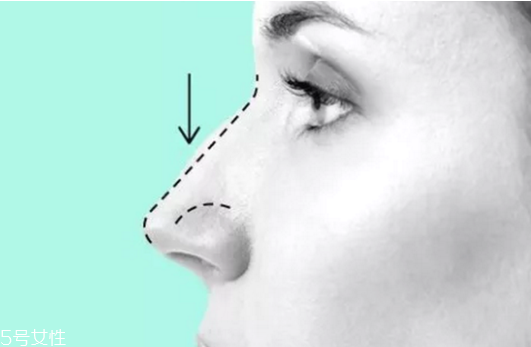 伊婉c是中分子嗎 伊婉玻尿酸真假對(duì)比圖片 伊婉c是中分子嗎 伊婉玻尿酸真假對(duì)比圖片