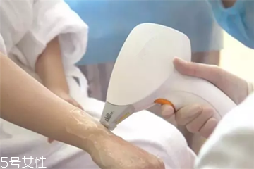 超冰脫毛疼嗎 超冰脫毛疼痛感怎樣 超冰脫毛疼嗎 超冰脫毛疼痛感怎樣