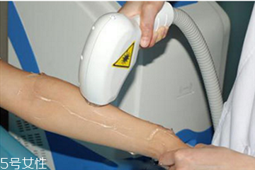 冰點(diǎn)脫毛危險(xiǎn)嗎 冰點(diǎn)脫毛前注意什么 冰點(diǎn)脫毛危險(xiǎn)嗎 冰點(diǎn)脫毛前注意什么