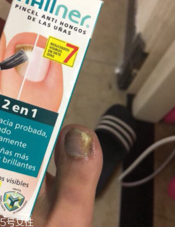 灰甲清有副作用嗎？灰甲清有哪些副作用？