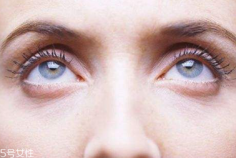 去眼袋手術(shù)幾天拆線好 去眼袋最永久的方法 去眼袋手術(shù)幾天拆線好 去眼袋最永久的方法
