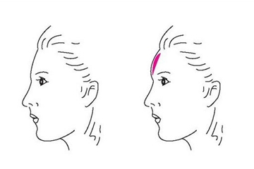 額頭化妝用什么化妝品 額頭怎么變飽滿漂亮 額頭化妝用什么化妝品 額頭怎么變飽滿漂亮