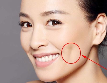 人造酒窩不笑也有嗎？人造酒窩自然嗎