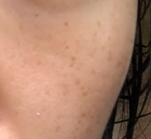 倩碧和蘭芝哪個(gè)檔次高？倩碧和蘭芝選擇