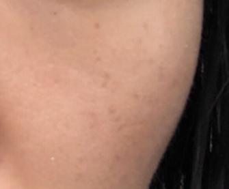 倩碧和蘭芝哪個(gè)檔次高？倩碧和蘭芝選擇