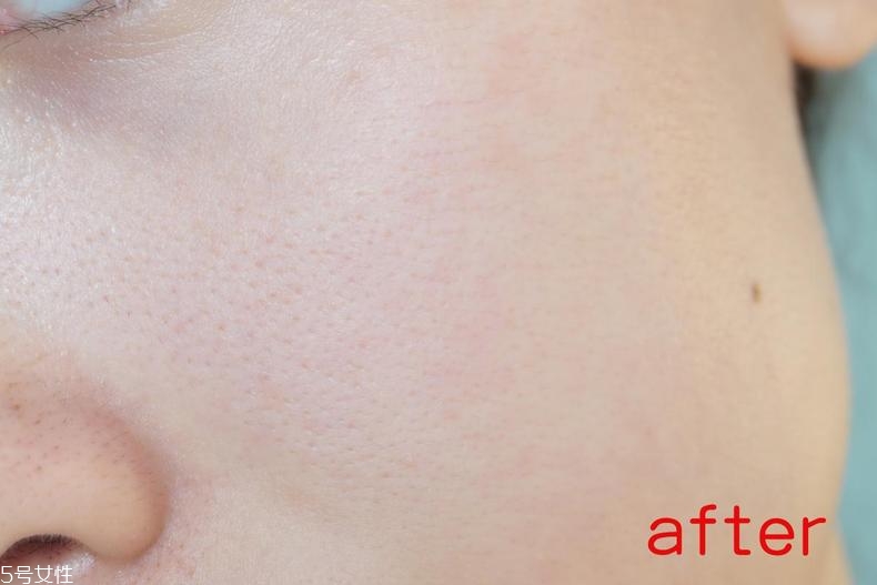 radha beauty vc精華白天能用嗎？敏感肌能用嗎？