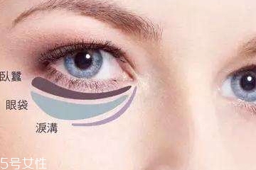 淚溝型黑眼圈怎么遮瑕 淚溝型黑眼圈的遮瑕方法 淚溝型黑眼圈怎么遮瑕 淚溝型黑眼圈的遮瑕方法