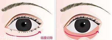 紅色黑眼圈怎么遮瑕 紅色黑眼圈用什么顏色遮瑕 紅色黑眼圈怎么遮瑕 紅色黑眼圈用什么顏色遮瑕