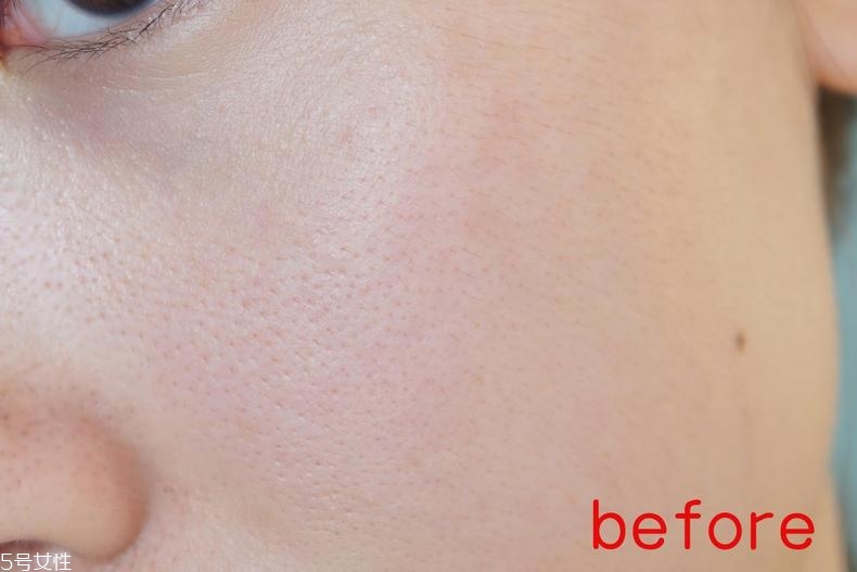 radha beauty vc精華白天能用嗎？敏感肌能用嗎？