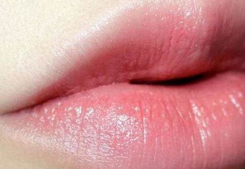 厚唇變薄術(shù)會(huì)反彈嗎？厚唇變薄術(shù)的真實(shí)經(jīng)歷