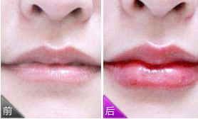 紋唇多少錢？紋唇風險大嗎