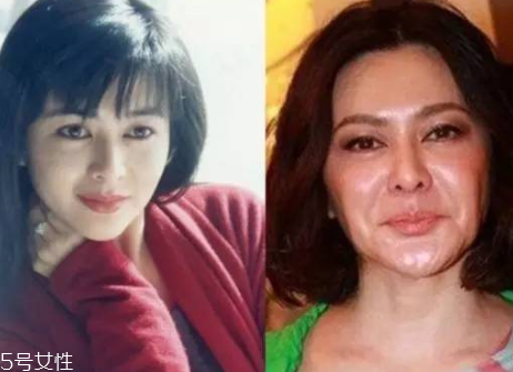 顴骨墊高手術(shù)風(fēng)險(xiǎn)大嗎 顴骨墊高會(huì)不會(huì)失敗 顴骨墊高手術(shù)風(fēng)險(xiǎn)大嗎 顴骨墊高會(huì)不會(huì)失敗