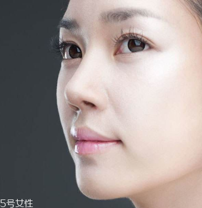 墊鼻尖后多久能做運(yùn)動(dòng) 墊鼻尖后做運(yùn)動(dòng)要注意什么 墊鼻尖后多久能做運(yùn)動(dòng) 墊鼻尖后做運(yùn)動(dòng)要注意什么