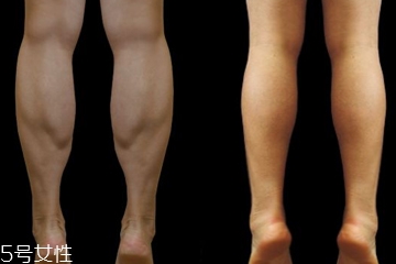 瘦小腿手術(shù)價(jià)格多少 瘦小腿手術(shù)很貴嗎 瘦小腿手術(shù)價(jià)格多少 瘦小腿手術(shù)很貴嗎