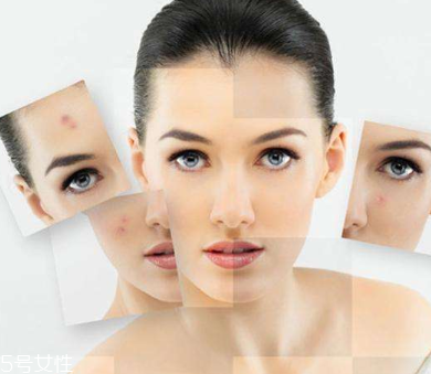 祛痘手術(shù)需要多少錢 祛痘手術(shù)費(fèi)用很高嗎 祛痘手術(shù)需要多少錢 祛痘手術(shù)費(fèi)用很高嗎