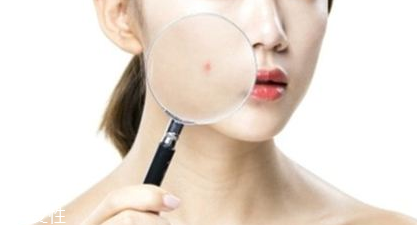 祛痘手術(shù)后多久能洗臉 祛痘手術(shù)后能用熱水洗臉嗎 祛痘手術(shù)后多久能洗臉 祛痘手術(shù)后能用熱水洗臉嗎