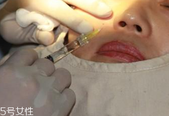 玻尿酸分哪幾種 不同種類玻尿酸怎么挑選 玻尿酸分哪幾種 不同種類玻尿酸怎么挑選