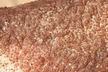 海藻面膜能去黑頭嗎？海藻面膜有去黑頭功效嗎？