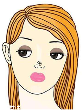 黑頭不管它會變大嗎？黑頭不管它會怎樣？