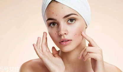 頑固痘痘怎么消除？油皮為什么反復爆痘？