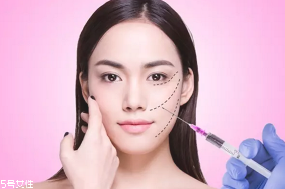 打瘦臉針一針多少錢啊 瘦臉針多少錢一針 打瘦臉針一針多少錢啊 瘦臉針多少錢一針