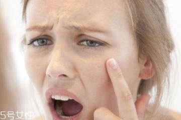 熬夜怎么預(yù)防長痘痘？熬夜避免爆痘的方法