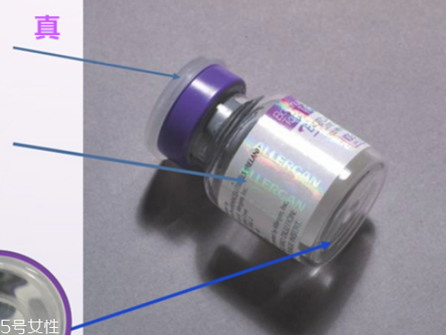 保妥適瘦臉針副作用 教你辨別保妥適瘦臉針真假 保妥適瘦臉針副作用 教你辨別保妥適瘦臉針真假