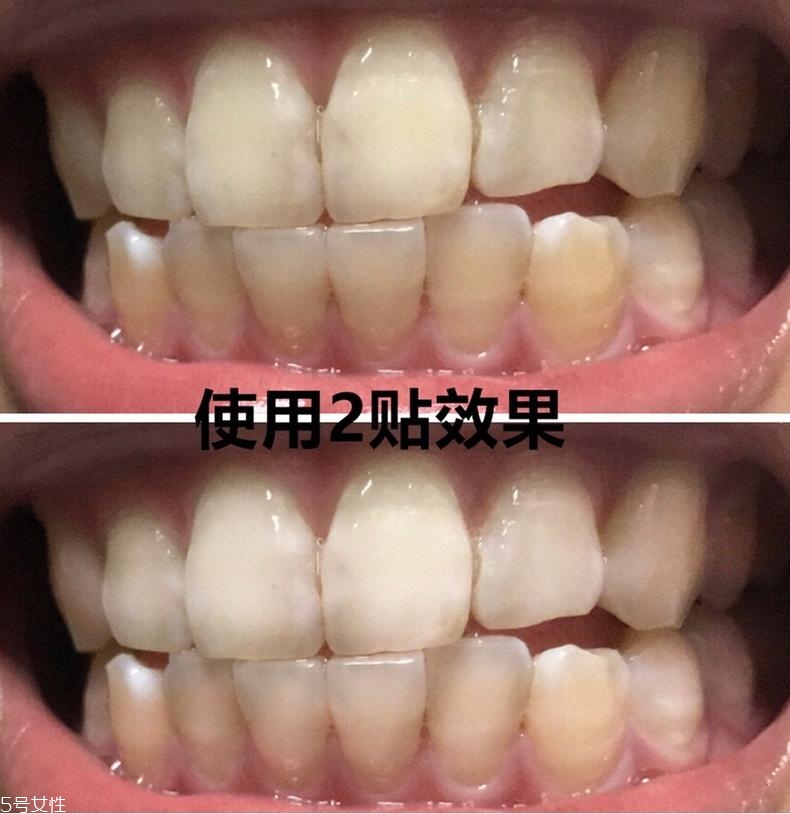 佳潔士美白牙貼貼多久有效？佳潔士美白牙貼使用感受