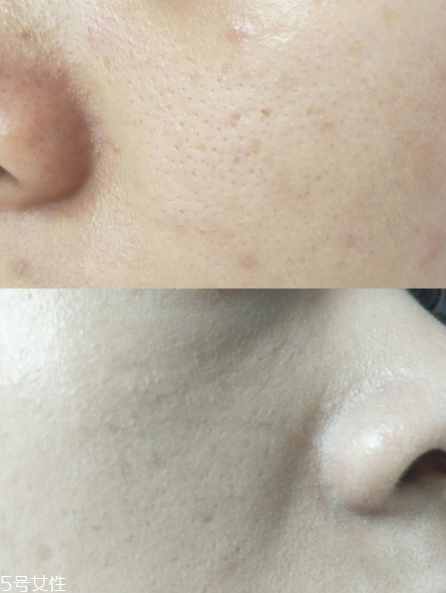 歐萊雅紅胖子氣墊有替換裝嗎 蔡徐坤最新代言氣墊 歐萊雅紅胖子氣墊有替換裝嗎 蔡徐坤最新代言氣墊