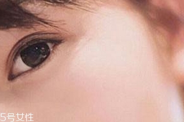美瞳會傷眼睛嗎 多多少少有一點 美瞳會傷眼睛嗎 多多少少有一點