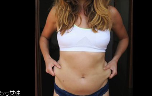 產(chǎn)后皮膚松弛怎么辦 產(chǎn)后肚子皮膚松弛解決方法 產(chǎn)后皮膚松弛怎么辦 產(chǎn)后肚子皮膚松弛解決方法