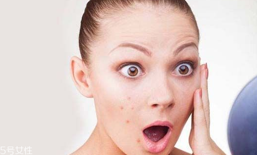 粉刺痘痘用什么爽膚水好 還你光滑小臉蛋 粉刺痘痘用什么爽膚水好 還你光滑小臉蛋