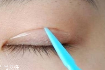 雙眼皮貼和纖維條哪個好用 雙眼皮貼和纖維條哪個好用