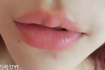 嘟嘟唇是天生的嗎 天生人工的都有 嘟嘟唇是天生的嗎 天生人工的都有