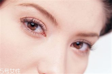 哪些人不適合做雙眼皮 不宜割雙眼皮的人群 哪些人不適合做雙眼皮 不宜割雙眼皮的人群